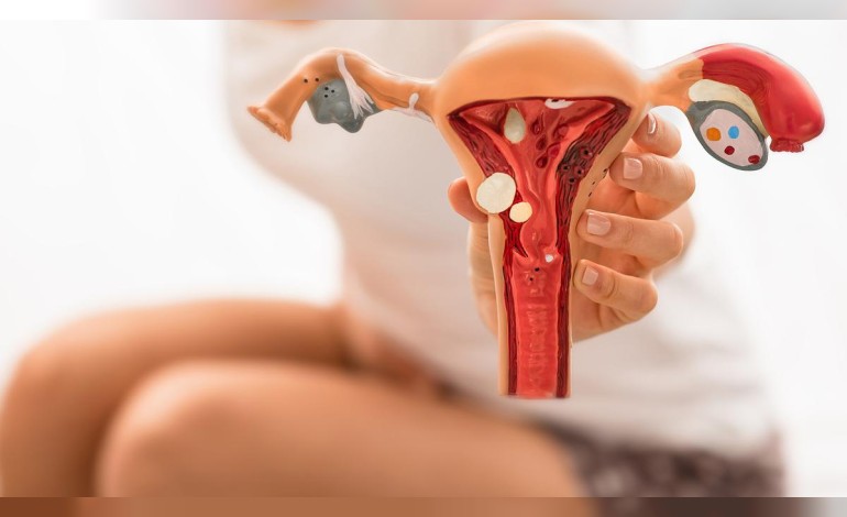 Endometriosis pain leads to missed school and work in two-thirds of women with condition, new study finds