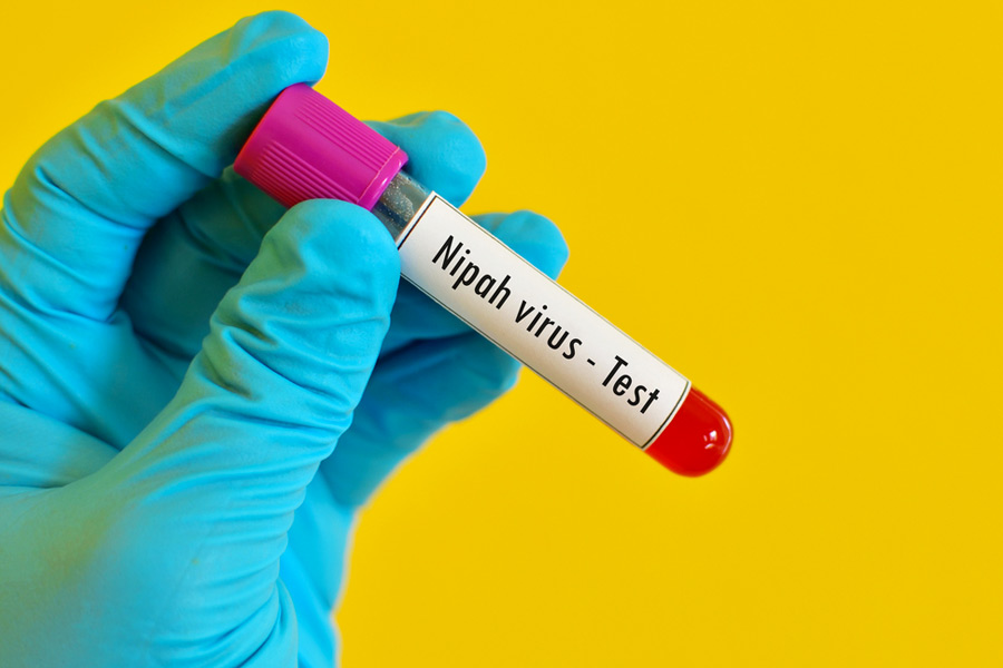 National Institute of Virology develops portable 'point-of-care' test kit for detecting Nipah virus